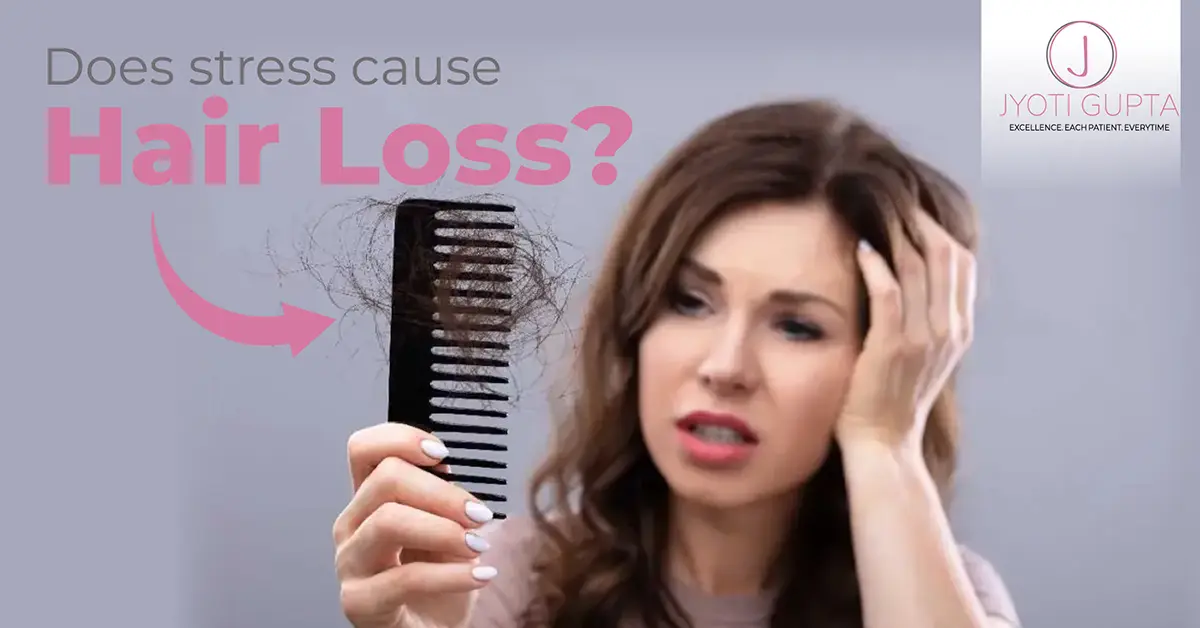 Stress Cause Hair Loss