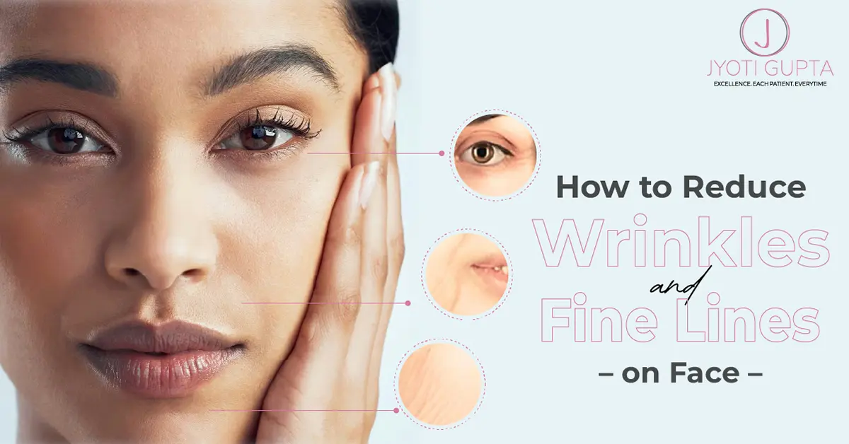 How to Reduce Wrinkles and Fine Lines on Face
