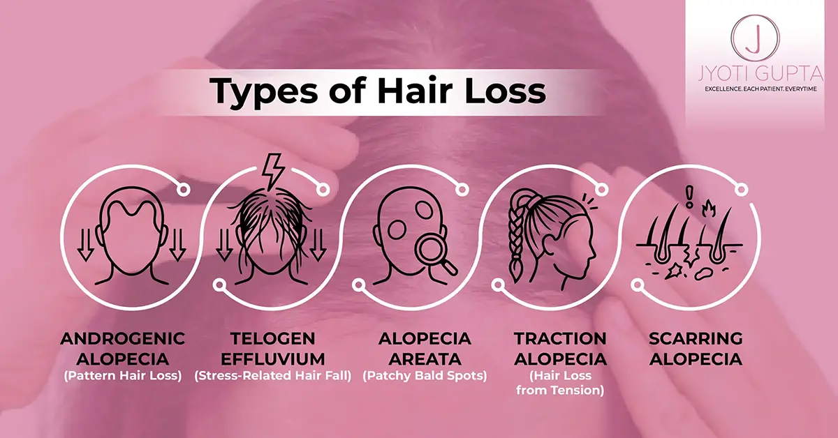 Types of Hair Loss