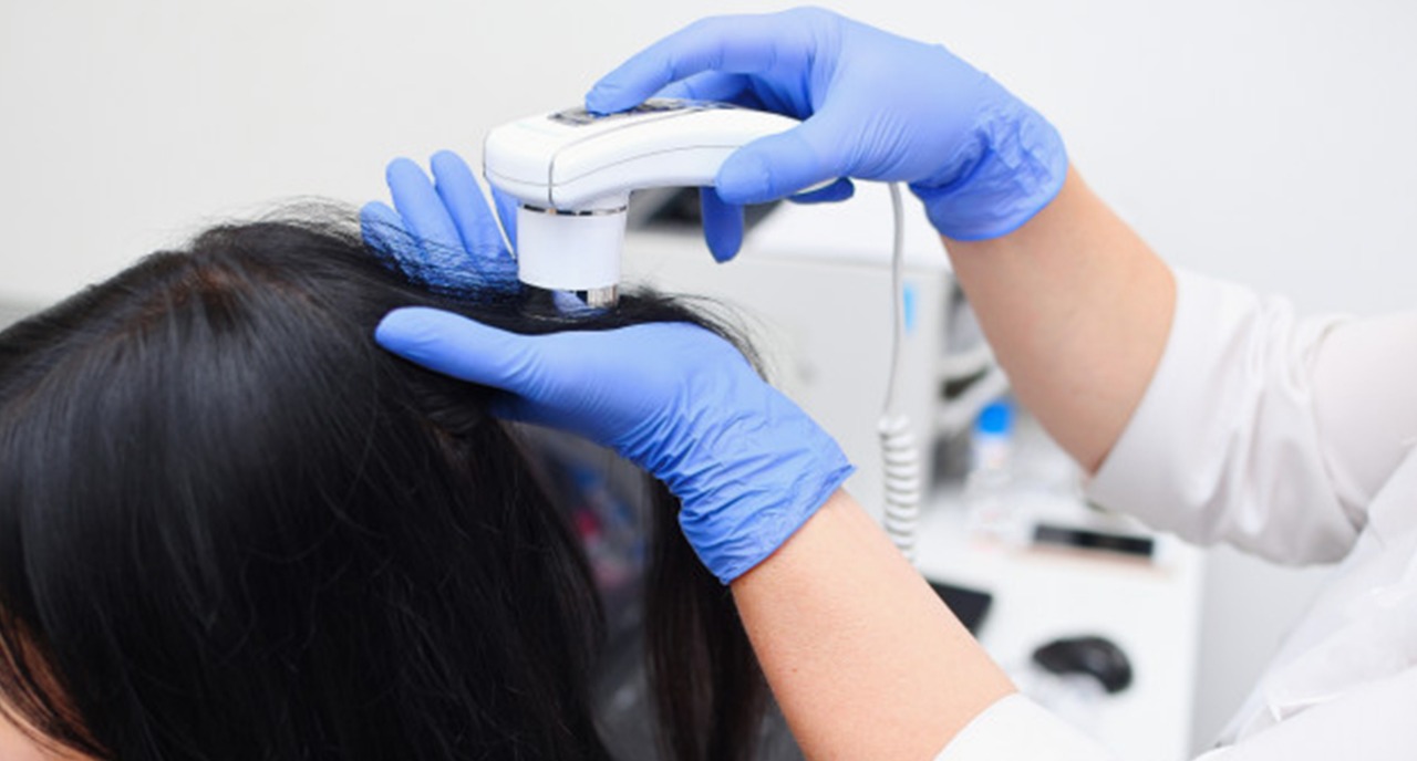 Hair Loss Treatment Hair Loss Treatment