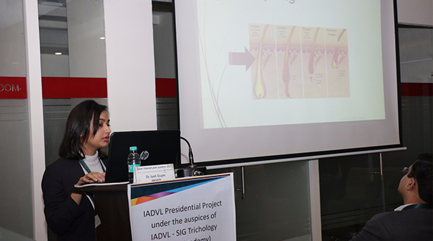 Workshop & Lecture given about Hair Transplantation at Hair Summit, New Delhi
